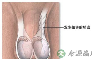 初三男孩半夜睾丸扭转 或影响生育能力