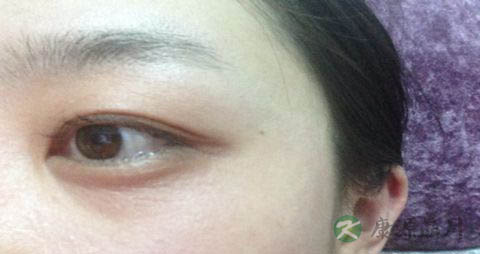 如何让皱纹晚点到_怎样去除皱纹