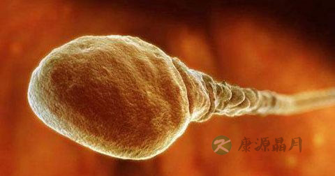 精子计数