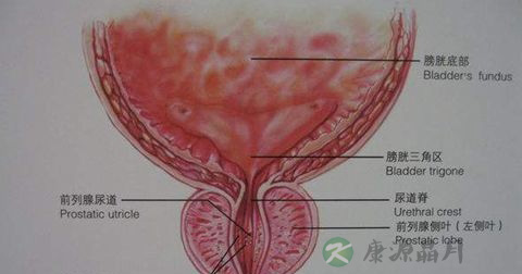 小便刺痛