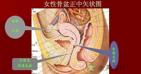 TCT检查