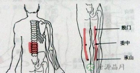 腰椎间盘突出