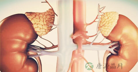 肾积水