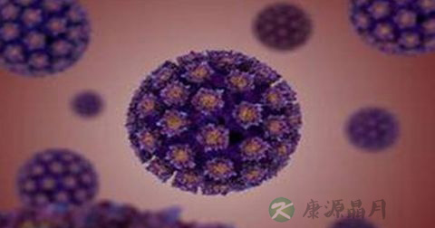 尖锐湿疣