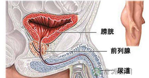 阳痿