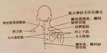 胡超伟讲针灸：第二讲 秒杀肩周炎