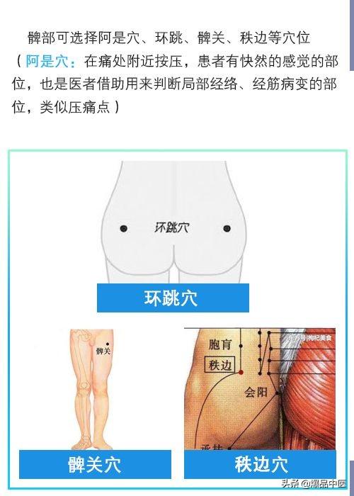 门诊干货｜针灸治疗类风湿关节炎配穴