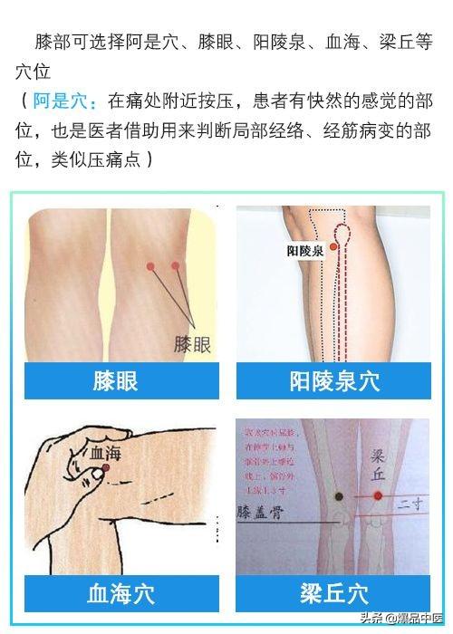 门诊干货｜针灸治疗类风湿关节炎配穴