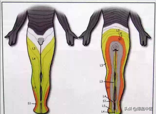 超级实用的腰腿痛临床诊断思维，值得收藏