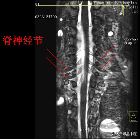 椎管解剖（高清大图）