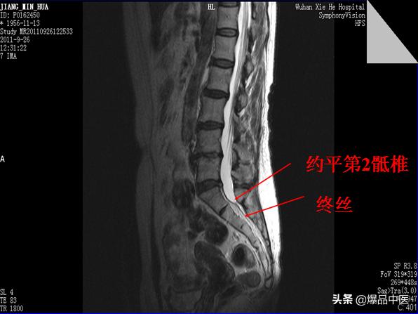 椎管解剖（高清大图）