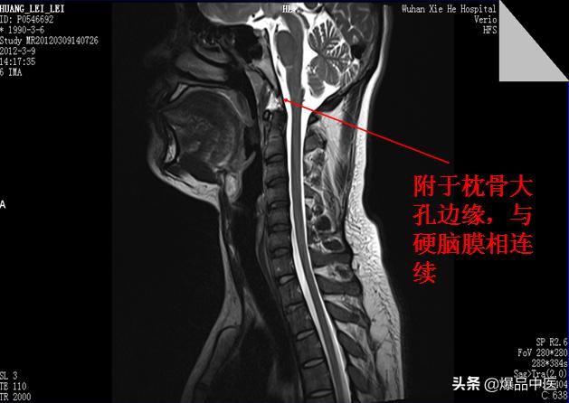 椎管解剖（高清大图）