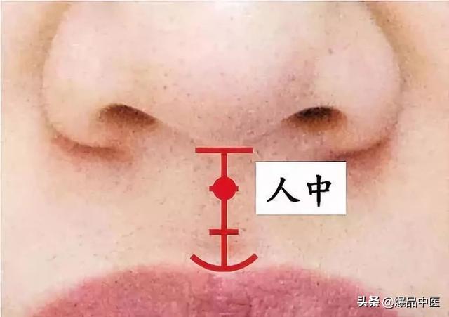 经典图文：治痛25套中医对穴组合