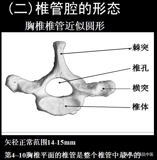 椎管解剖（高清大图）