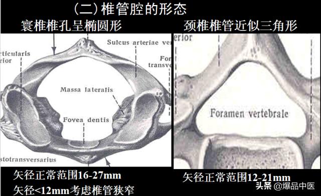 椎管解剖（高清大图）