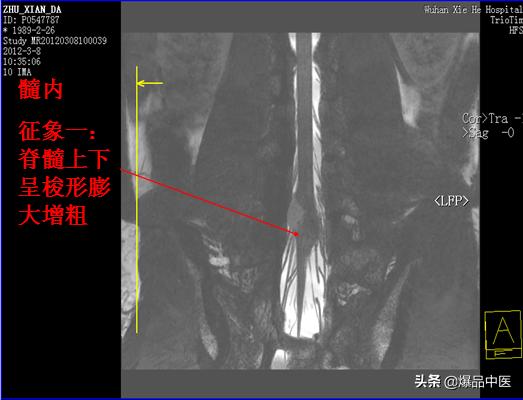 椎管解剖（高清大图）