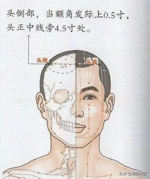 经典图文：治痛25套中医对穴组合