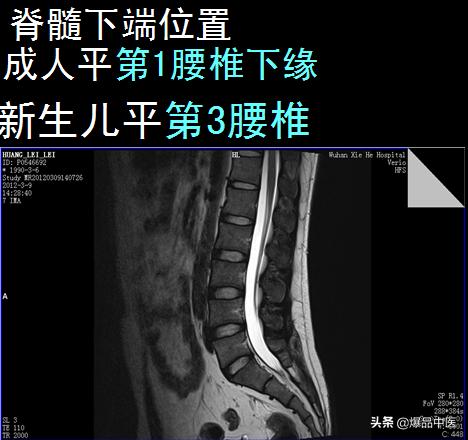 椎管解剖（高清大图）