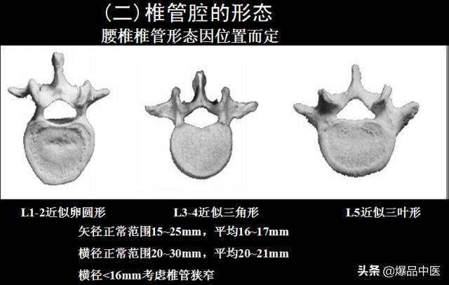 椎管解剖（高清大图）