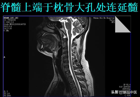 椎管解剖（高清大图）