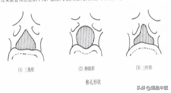 超实用脊椎解剖图解