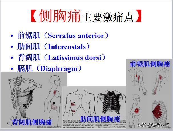 「图文并茂」全身激痛点