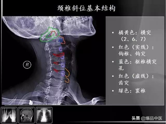 颈椎阅片的基础知识