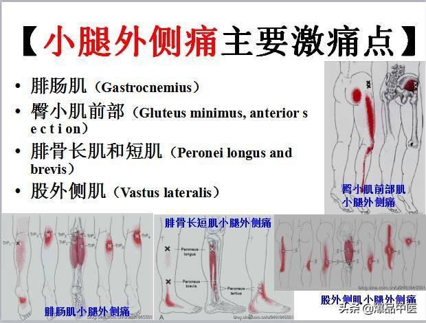 「图文并茂」全身激痛点