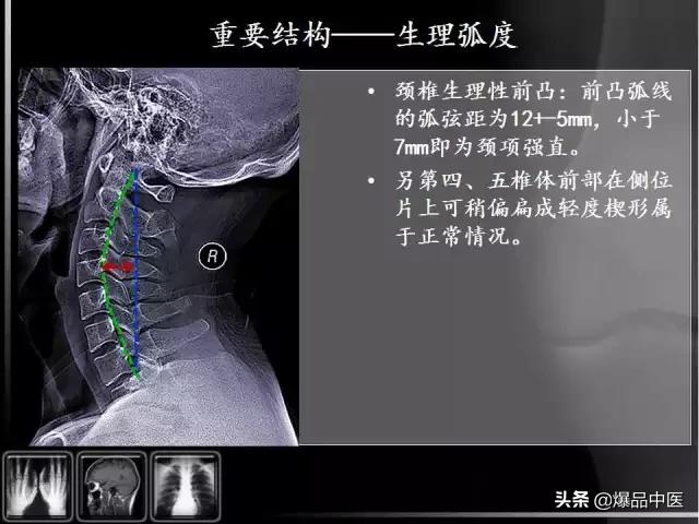 颈椎阅片的基础知识