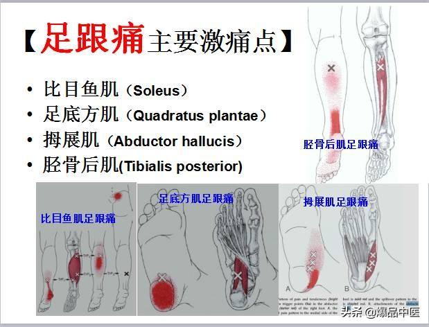 「图文并茂」全身激痛点