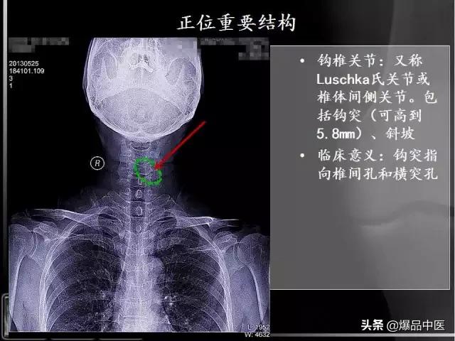 颈椎阅片的基础知识