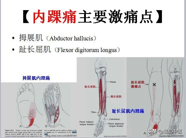 「图文并茂」全身激痛点