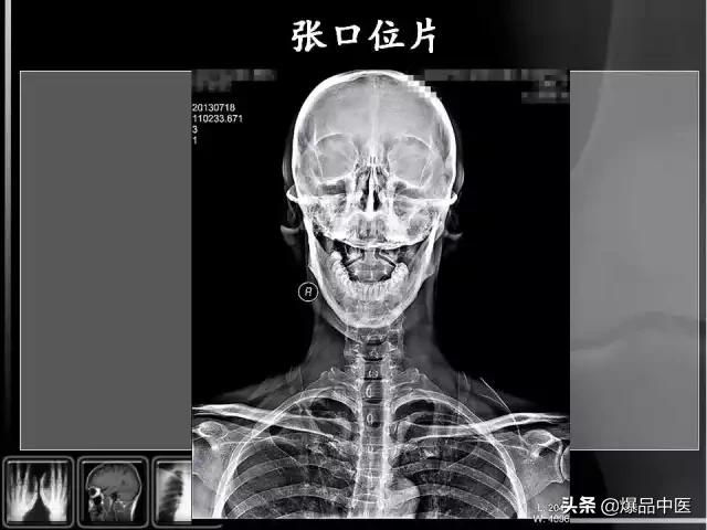 颈椎阅片的基础知识