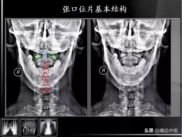 颈椎阅片的基础知识