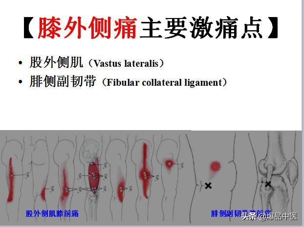 「图文并茂」全身激痛点