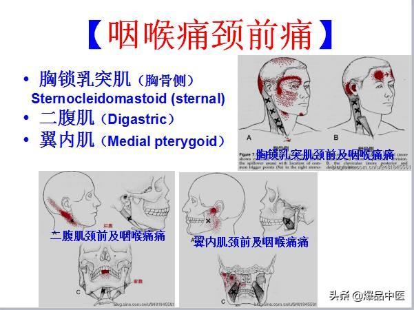 「图文并茂」全身激痛点