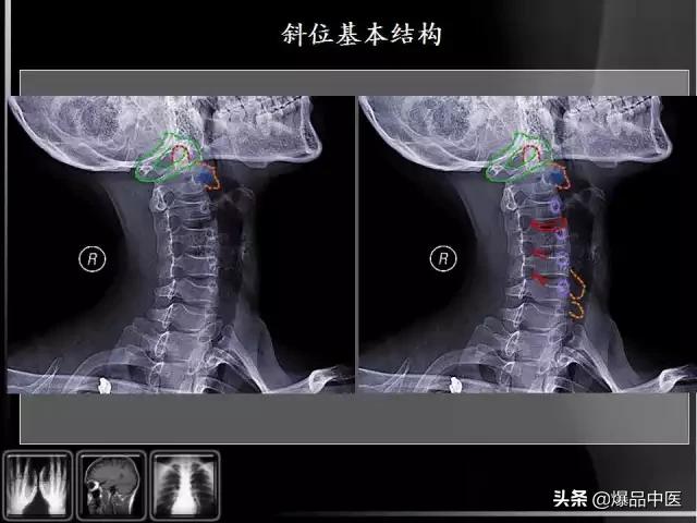 颈椎阅片的基础知识