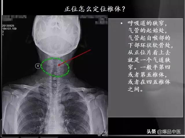 颈椎阅片的基础知识