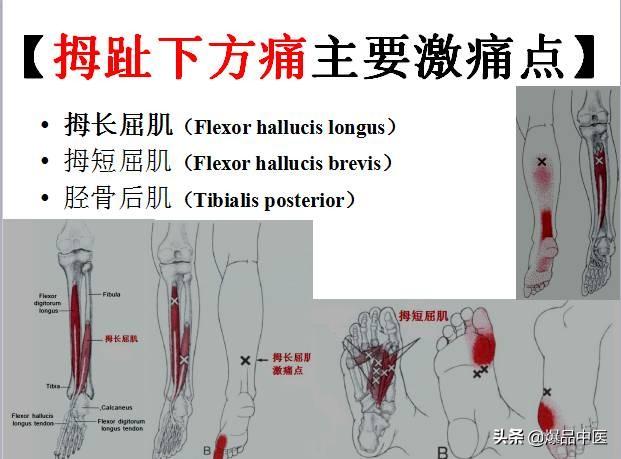 「图文并茂」全身激痛点