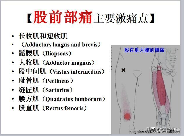 「图文并茂」全身激痛点