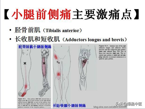 「图文并茂」全身激痛点