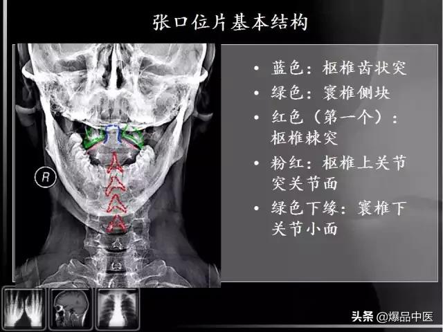 颈椎阅片的基础知识