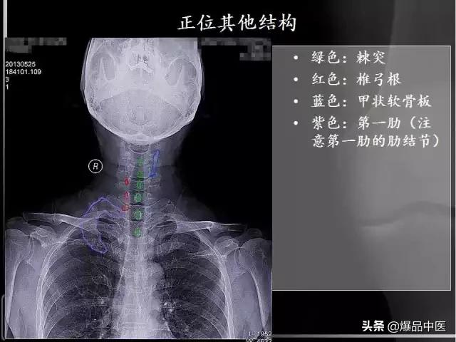 颈椎阅片的基础知识