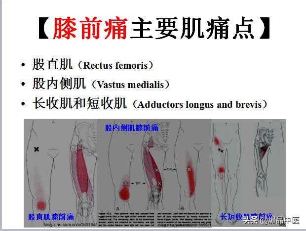 「图文并茂」全身激痛点