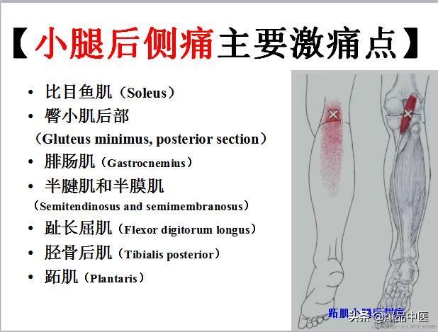 「图文并茂」全身激痛点