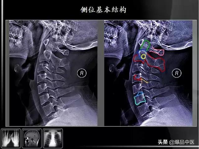 颈椎阅片的基础知识