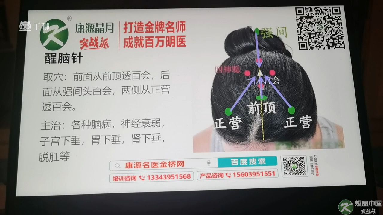 醒脑针-民间针灸绝技&葛建勋老师