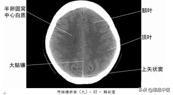 全身CT图谱