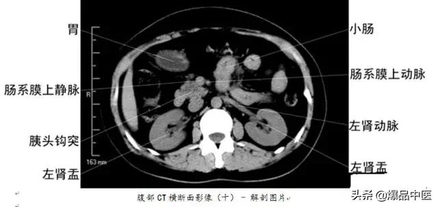 全身CT图谱