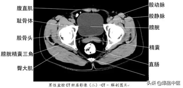 全身CT图谱